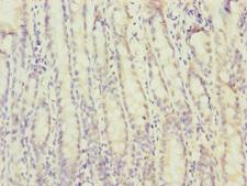 MTERF2 / MTERFD3 Antibody - Immunohistochemistry of paraffin-embedded human small intestine tissue at dilution of 1:100