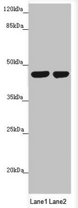 MTERF2 / MTERFD3 Antibody - Western blot All Lanes:MTERFD3 antibody at 1.66 ug/ml Lane 1: U251 whole cell lysate Lane 2: HepG-2 whole cell lysate Secondary Goat polyclonal to rabbit IgG at 1/10000 dilution Predicted band size: 44 kDa Observed band size: 44 kDa