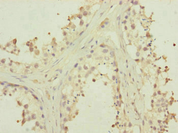 MTERF2 / MTERFD3 Antibody - Immunohistochemistry of paraffin-embedded human testis tissue at dilution of 1:100