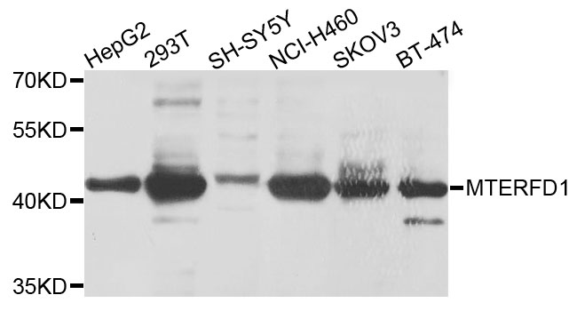 MTERF3 / MTERFD1 Antibody - Western blot analysis of extracts of various cells.