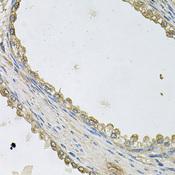 MTERF3 / MTERFD1 Antibody - Immunohistochemistry of paraffin-embedded human prostate.