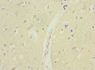 MTERF3 / MTERFD1 Antibody - Immunohistochemistry of paraffin-embedded human brain tissue at dilution 1:100