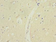 MTERF3 / MTERFD1 Antibody - Immunohistochemistry of paraffin-embedded human brain tissue at dilution 1:100