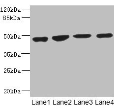 MTERF3 / MTERFD1 Antibody - Western blot All Lanes: MTERFD1 antibody at 3.94ug/ml Lane 1: U251 whole cell lysate Lane 2: 293T whole cell lysate Lane 3: Hela whole cell lysate Lane 4: K562 whole cell lysate Secondary Goat polyclonal to rabbit IgG at 1/10000 dilution Predicted band size: 48,38,35 kDa Observed band size: 48 kDa
