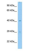 MTERF4 / MTERFD2 Antibody - Mterfd2 antibody Western Blot of Mouse Testis.  This image was taken for the unconjugated form of this product. Other forms have not been tested.