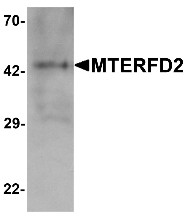 MTERF4 / MTERFD2 Antibody - Western blot analysis of MTERFD2 in human small intestine tissue lysate with MTERFD2 antibody at 1 ug/ml.