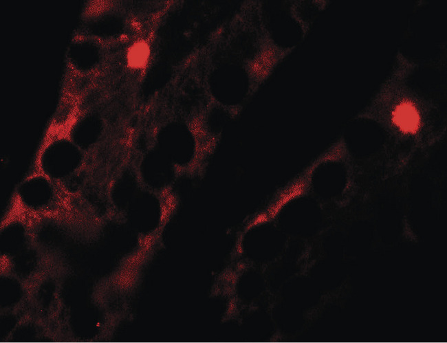 MTERF4 / MTERFD2 Antibody - Immunofluorescence of MTERFD2 in human small intestine tissue with MTERFD2 antibody at 20 ug/ml.