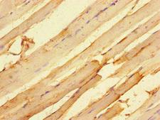 MTERF4 / MTERFD2 Antibody - Immunohistochemistry of paraffin-embedded human skeletal muscle tissue at dilution of 1:100