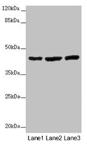 MTERF4 / MTERFD2 Antibody - Western blot All Lanes :MTERF4 antibody at 2 ug/ml Lane 1 : Mouse kidney tissue Lane 2 : HL60 whole cell lysate Lane 3 : A549 whole cell lysate Secondary Goat polyclonal to rabbit IgG at 1/10000 dilution Predicted band size: 44 kDa Observed band size: 44 kDa