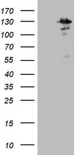 MTF-1 Antibody - HEK293T cells were transfected with the pCMV6-ENTRY control. (Left lane) or pCMV6-ENTRY MTF1. (Right lane) cDNA for 48 hrs and lysed. Equivalent amounts of cell lysates. (5 ug per lane) were separated by SDS-PAGE and immunoblotted with anti-MTF1. (1:2000)