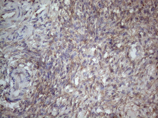 MTF-1 Antibody - Immunohistochemical staining of paraffin-embedded Human Ovary tissue within the normal limits using anti-MTF1 mouse monoclonal antibody. (Heat-induced epitope retrieval by 1mM EDTA in 10mM Tris buffer. (pH8.5) at 120°C for 3 min. (1:150)