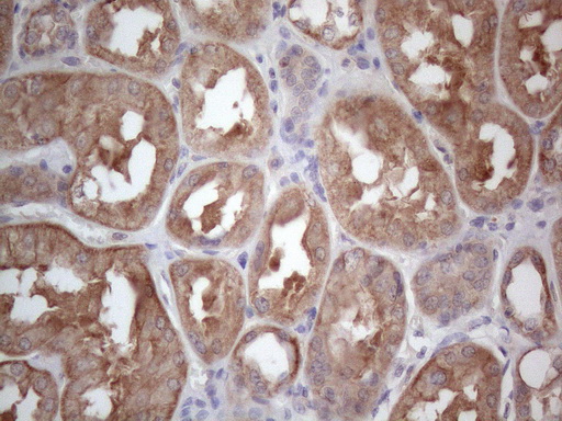 MTF-1 Antibody - Immunohistochemical staining of paraffin-embedded Human Kidney tissue within the normal limits using anti-MTF1 mouse monoclonal antibody. (Heat-induced epitope retrieval by 1mM EDTA in 10mM Tris buffer. (pH8.5) at 120°C for 3 min. (1:150)