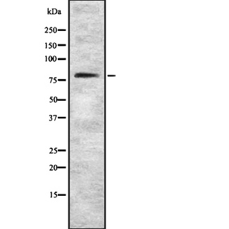 MTF-1 Antibody - Western blot analysis of MTF1 using Jurkat whole cells lysates