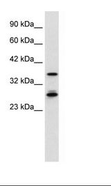 MTF2 / PCL2 Antibody - HepG2 Cell Lysate.  This image was taken for the unconjugated form of this product. Other forms have not been tested.