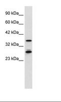 MTF2 / PCL2 Antibody - HepG2 Cell Lysate.  This image was taken for the unconjugated form of this product. Other forms have not been tested.