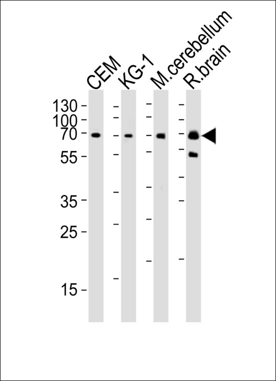 MTF2 / PCL2 Antibody - Western blot of lysates from CEM, KG-1 cell line, mouse cerebellum and rat brain tissue lysate (from left to right), using MTF2 Antibody. Antibody was diluted at 1:1000 at each lane. A goat anti-rabbit IgG H&L (HRP) at 1:10000 dilution was used as the secondary antibody. Lysates at 35ug per lane.