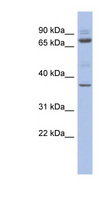 MTF2 / PCL2 Antibody - MTF2 antibody Western blot of THP-1 cell lysate. This image was taken for the unconjugated form of this product. Other forms have not been tested.
