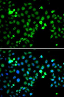 MTF2 / PCL2 Antibody - Immunofluorescence analysis of A549 cells.