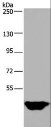 MTF2 / PCL2 Antibody - Western blot analysis of Human testis tissue, using MTF2 Polyclonal Antibody at dilution of 1:400.