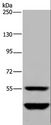 MTF2 / PCL2 Antibody - Western blot analysis of Human testis tissue, using MTF2 Polyclonal Antibody at dilution of 1:400.