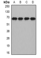 MTF2 / PCL2 Antibody - Western blot analysis of MTF-2 expression in HL60 (A); HepG2 (B); mouse brain (C); rat brain (D) whole cell lysates.