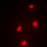 MTF2 / PCL2 Antibody - Immunofluorescent analysis of MTF-2 staining in A549 cells. Formalin-fixed cells were permeabilized with 0.1% Triton X-100 in TBS for 5-10 minutes and blocked with 3% BSA-PBS for 30 minutes at room temperature. Cells were probed with the primary antibody in 3% BSA-PBS and incubated overnight at 4 deg C in a humidified chamber. Cells were washed with PBST and incubated with a DyLight 594-conjugated secondary antibody (red) in PBS at room temperature in the dark.
