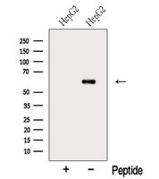 MTF2 / PCL2 Antibody - Western blot analysis of extracts of HepG2 cells using MTF2 antibody. The lane on the left was treated with blocking peptide.