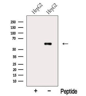 MTF2 / PCL2 Antibody - Western blot analysis of extracts of HepG2 cells using MTF2 antibody. The lane on the left was treated with blocking peptide.