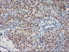 MTFMT Antibody - IHC of paraffin-embedded Human pancreas tissue using anti-MTFMT mouse monoclonal antibody. (Heat-induced epitope retrieval by 10mM citric buffer, pH6.0, 100C for 10min).
