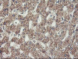 MTFMT Antibody - IHC of paraffin-embedded Human liver tissue using anti-MTFMT mouse monoclonal antibody. (Heat-induced epitope retrieval by 10mM citric buffer, pH6.0, 100C for 10min).