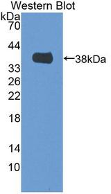 MTFMT Antibody - Western blot of MTFMT antibody.