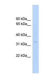 MTFMT Antibody - MTFMT antibody Western blot of Fetal Liver lysate. This image was taken for the unconjugated form of this product. Other forms have not been tested.