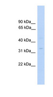 MTFMT Antibody - MTFMT antibody Western blot of Fetal Liver lysate. This image was taken for the unconjugated form of this product. Other forms have not been tested.
