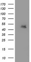 MTFMT Antibody - HEK293T cells were transfected with the pCMV6-ENTRY control (Left lane) or pCMV6-ENTRY MTFMT (Right lane) cDNA for 48 hrs and lysed. Equivalent amounts of cell lysates (5 ug per lane) were separated by SDS-PAGE and immunoblotted with anti-MTFMT.