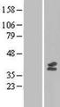 MTFMT Protein - Western validation with an anti-DDK antibody * L: Control HEK293 lysate R: Over-expression lysate