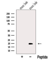 MTFP1 Antibody - Western blot analysis of extracts of mouse brain tissue using MTP18 antibody. The lane on the left was treated with blocking peptide.