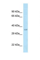 MTFR1 Antibody - MTFR1 antibody Western blot of Fetal Liver lysate. Antibody concentration 1 ug/ml.  This image was taken for the unconjugated form of this product. Other forms have not been tested.