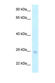 MTG1 / Mitochondrial GTPase 1 Antibody - MTG1 antibody Western blot of HepG2 Cell lysate. Antibody concentration 1 ug/ml.  This image was taken for the unconjugated form of this product. Other forms have not been tested.
