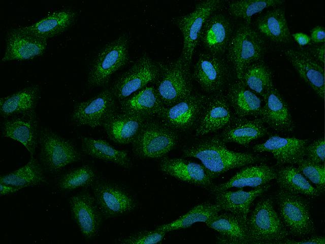 MTG1 / Mitochondrial GTPase 1 Antibody - Immunofluorescence staining of MTG1 in U2OS cells. Cells were fixed with 4% PFA, permeabilzed with 0.1% Triton X-100 in PBS, blocked with 10% serum, and incubated with rabbit anti-Human MTG1 polyclonal antibody (dilution ratio 1:100) at 4°C overnight. Then cells were stained with the Alexa Fluor 488-conjugated Goat Anti-rabbit IgG secondary antibody (green) and counterstained with DAPI (blue). Positive staining was localized to Cytoplasm.