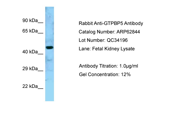 MTG2 / GTPBP5 Antibody -  This image was taken for the unconjugated form of this product. Other forms have not been tested.