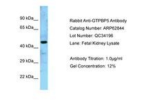 MTG2 / GTPBP5 Antibody -  This image was taken for the unconjugated form of this product. Other forms have not been tested.