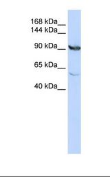 MTHFD1 Antibody - HepG2 cell lysate. Antibody concentration: 1.0 ug/ml. Gel concentration: 6-18%.  This image was taken for the unconjugated form of this product. Other forms have not been tested.