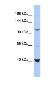 MTHFD1 Antibody - MTHFD1 antibody Western blot of OVCAR-3 cell lysate. This image was taken for the unconjugated form of this product. Other forms have not been tested.