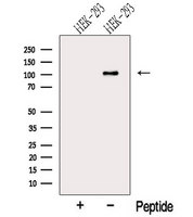 MTHFD1 Antibody - Western blot analysis of extracts of HEK293 cells using MTHFD1 antibody. The lane on the left was treated with blocking peptide.