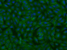 MTHFD1 Antibody - Immunofluorescence staining of MTHFD1 in U2OS cells. Cells were fixed with 4% PFA, permeabilzed with 0.1% Triton X-100 in PBS, blocked with 10% serum, and incubated with rabbit anti-Human MTHFD1 polyclonal antibody (dilution ratio 1:200) at 4°C overnight. Then cells were stained with the Alexa Fluor 488-conjugated Goat Anti-rabbit IgG secondary antibody (green) and counterstained with DAPI (blue). Positive staining was localized to Cytoplasm.