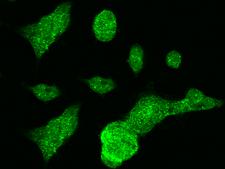 MTHFD1 Antibody - Immunofluorescence staining of MTHFD1 in 293 cells. Cells were fixed with 4% PFA, permeabilzed with 0.3% Triton X-100 in PBS, blocked with 10% serum, and incubated with rabbit anti-Human MTHFD1 polyclonal antibody (dilution ratio 1:1000) at 4°C overnight. Then cells were stained with the Alexa Fluor 488-conjugated Goat Anti-rabbit IgG secondary antibody (green). Positive staining was localized to cytoplasm.