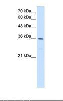 MTHFD2 Antibody - HepG2 cell lysate. Antibody concentration: 1.25 ug/ml. Gel concentration: 12%.  This image was taken for the unconjugated form of this product. Other forms have not been tested.