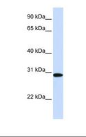 MTHFD2 Antibody - 293T cell lysate. Antibody concentration: 1.0 ug/ml. Gel concentration: 12%.  This image was taken for the unconjugated form of this product. Other forms have not been tested.