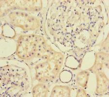 MTHFD2 Antibody - Immunohistochemistry of paraffin-embedded human kidney tissue at dilution of 1:100