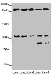 MTHFD2 Antibody - Western blot All Lanes: MTHFD2 antibody at 4.99 ug/ml Lane 1: A431 whole cell lysate Lane 2: HepG-2 whole cell lysate Lane 3: Hela whole cell lysate Lane 4: Raji whole cell lysate Lane 5: K562 whole cell lysate Secondary Goat polyclonal to rabbit IgG at 1/10000 dilution Predicted band size: 38,27 kDa Observed band size: 38,30,95 kDa